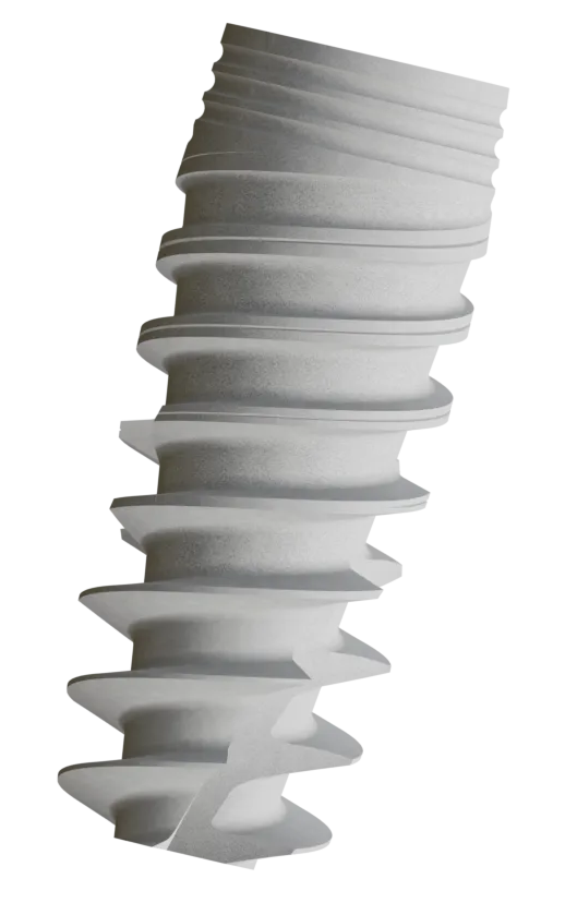 NB implant system
